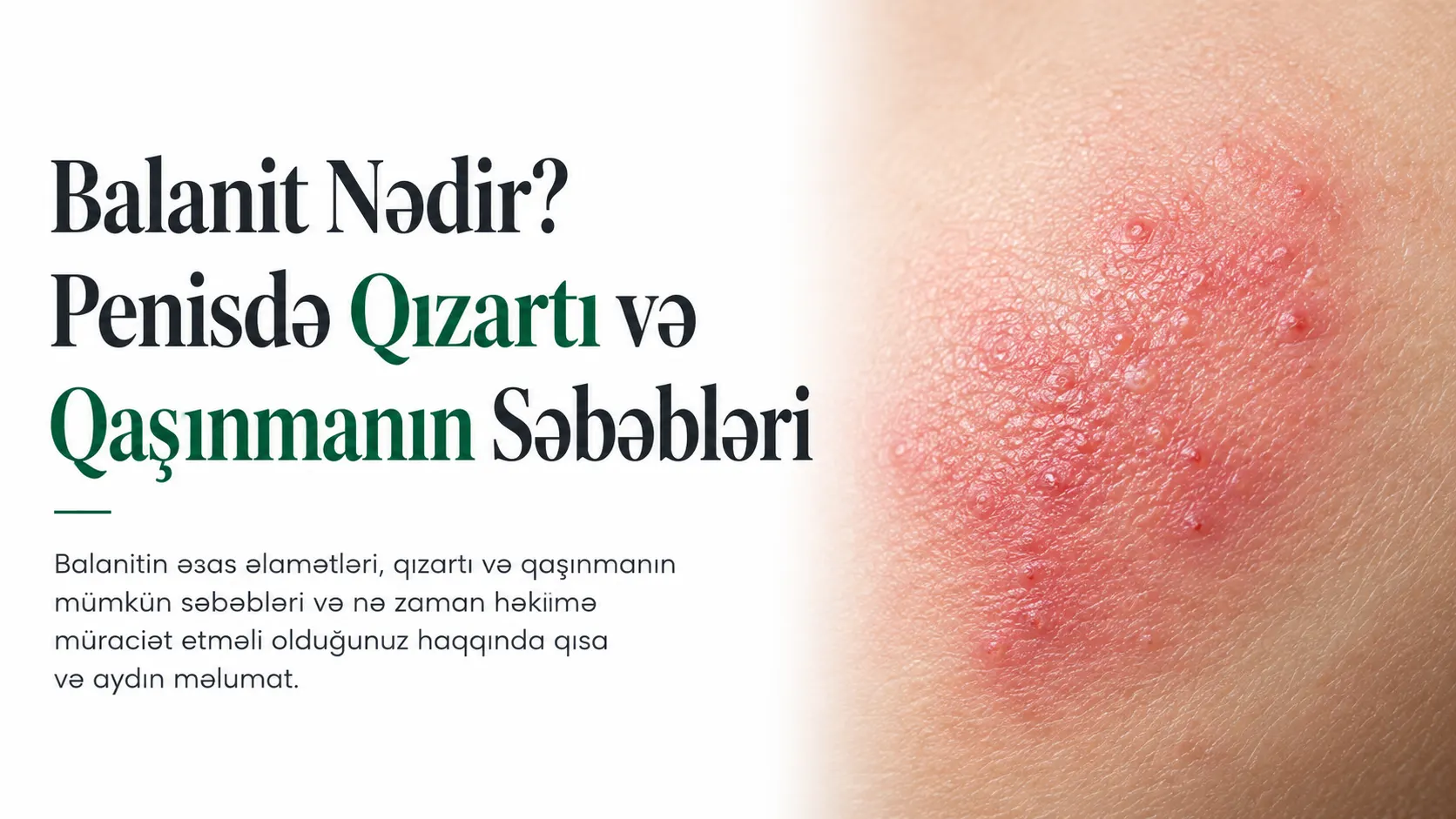 Balanit Nədir? Penisdə Qızartı və Qaşınmanın Səbəbləri
