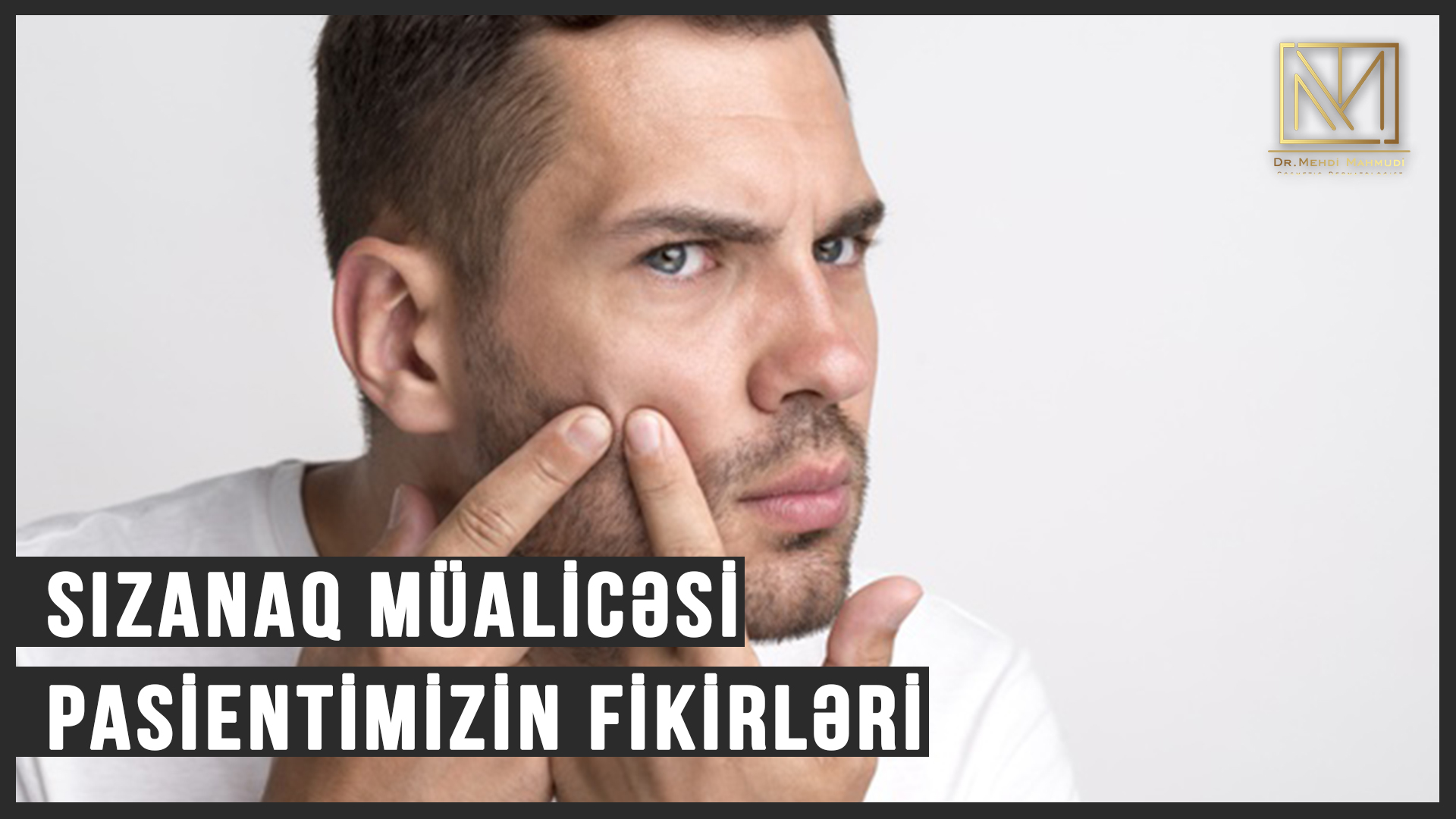 Akne (Sızanaq) səpgilərin müalicəsi haqqında Pasientimizin fikirləri - Dermatoloq Dr.Mehdi Mahmudi